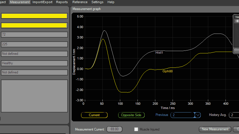 Muscle Tone Plot