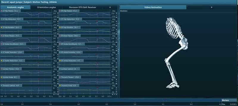 Noraxon Platform